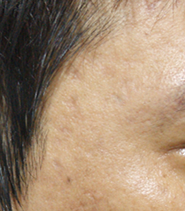 After